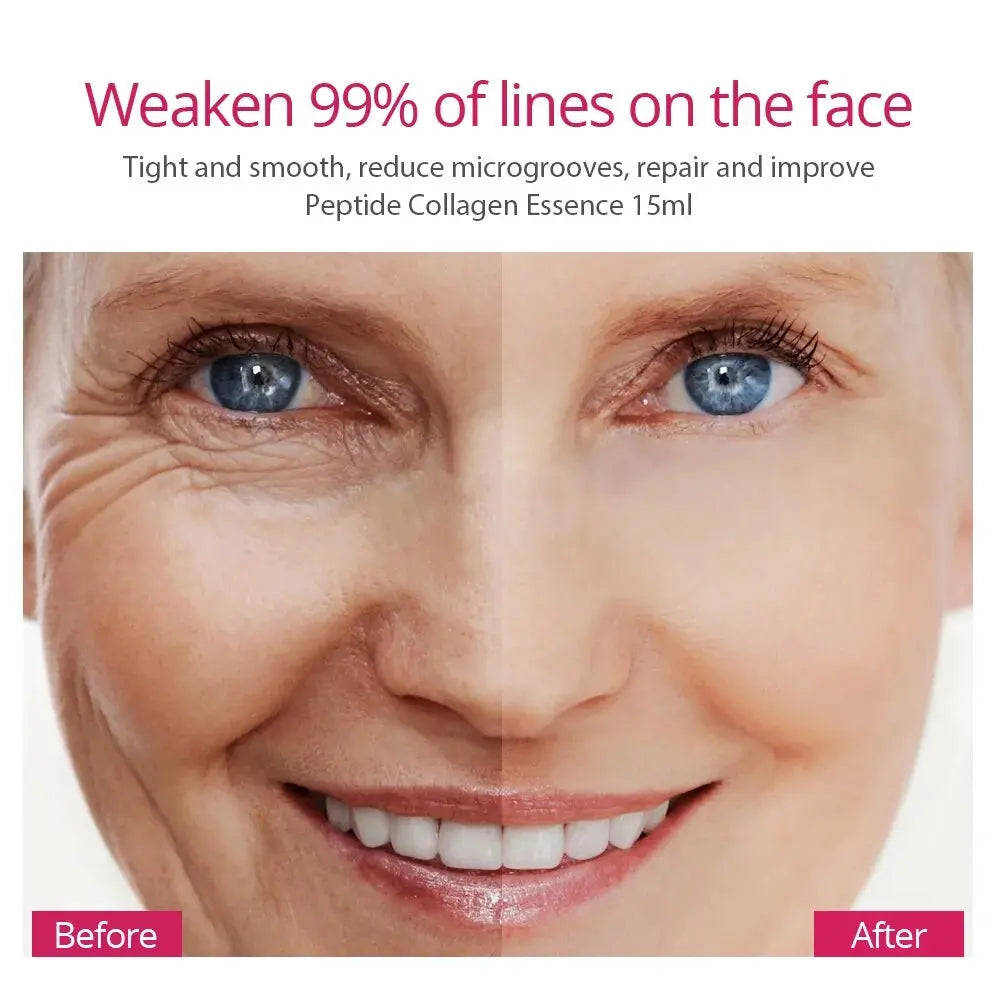 Collagen Peptides Face Serum Wrinkles Busted